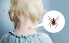 Attenti alle zecche!